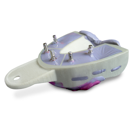 Miratray Implant Advanced Impression Trays, Intro Kit, 6/Pk