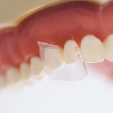 Directa - ProxyPal 3D Anterior Matrix, 604092