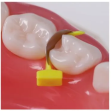 Directa - FenderMate Prime Short, Yellow 18/Pk. Unique combination of a preparation, 602816